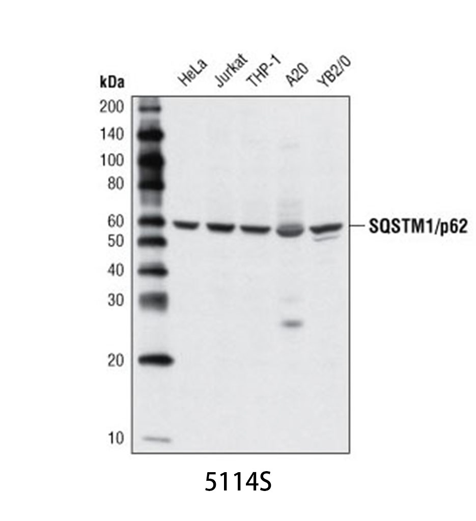 SQSTM1/p62 Antibody