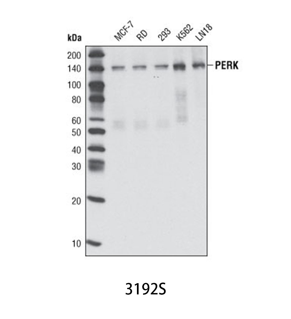 PERK (C33E10) Rabbit mAb