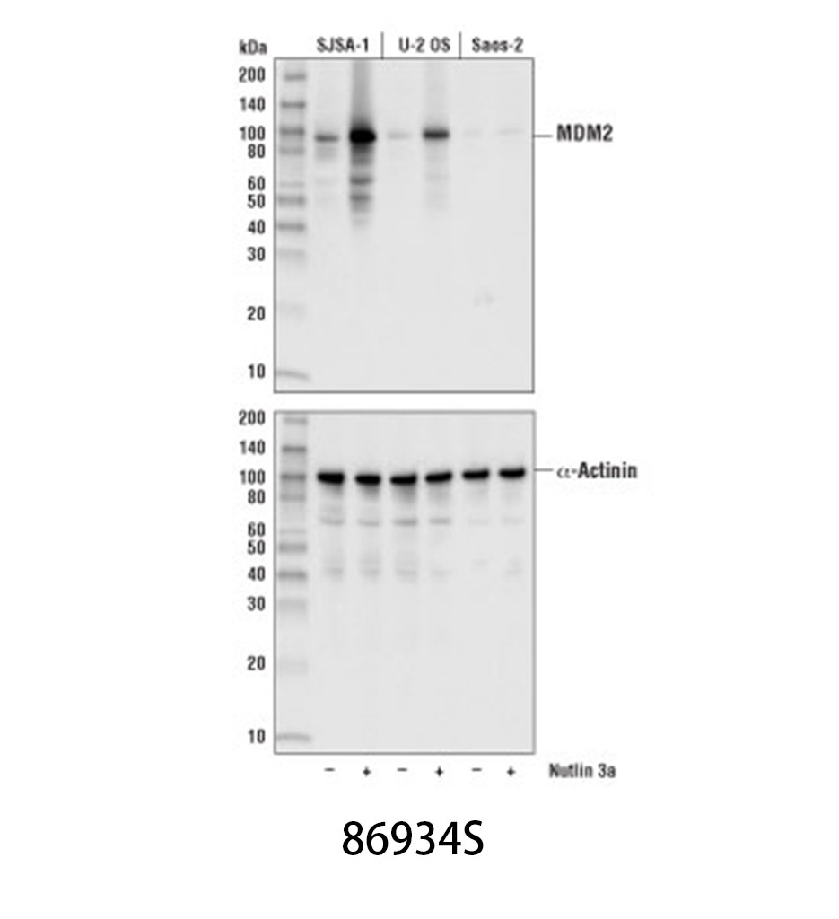 MDM2 (D1V2Z) Rabbit mAb