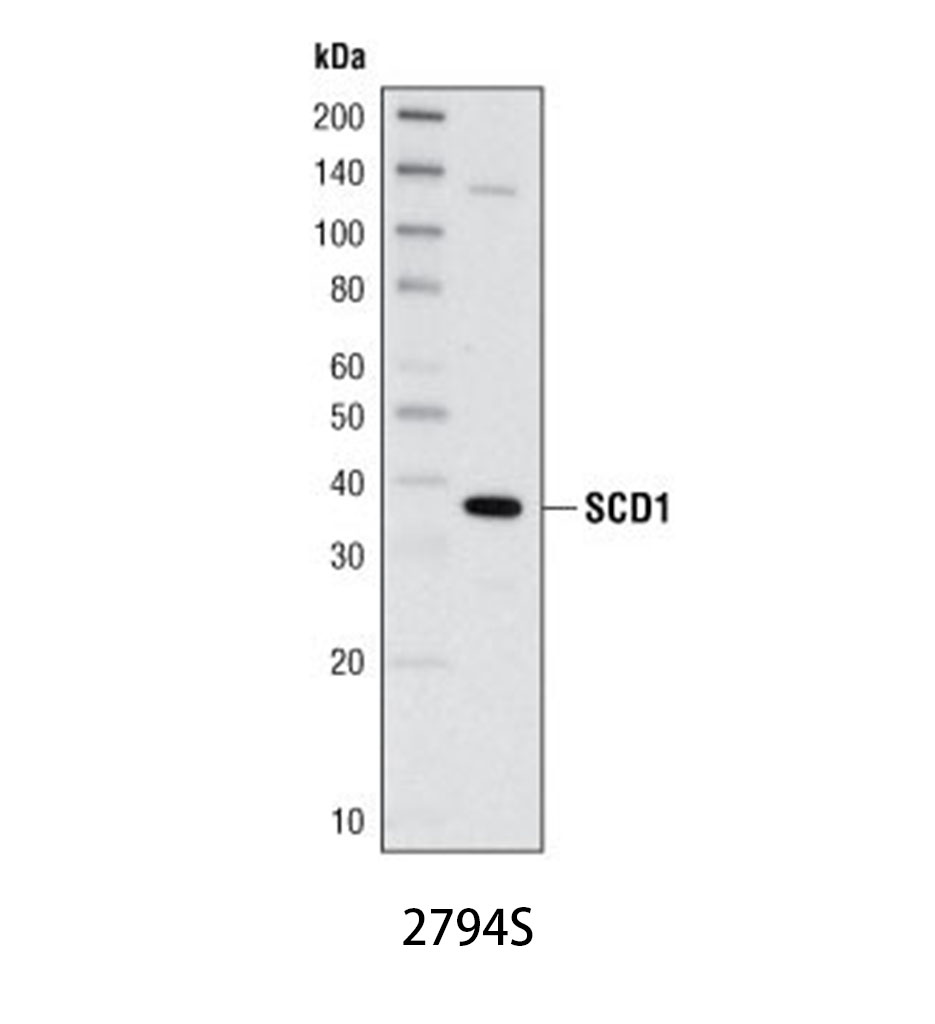 SCD1 (C12H5) Rabbit mAb