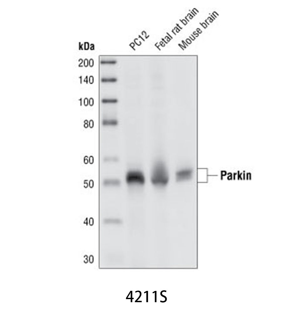 Parkin (Prk8) Mouse mAb