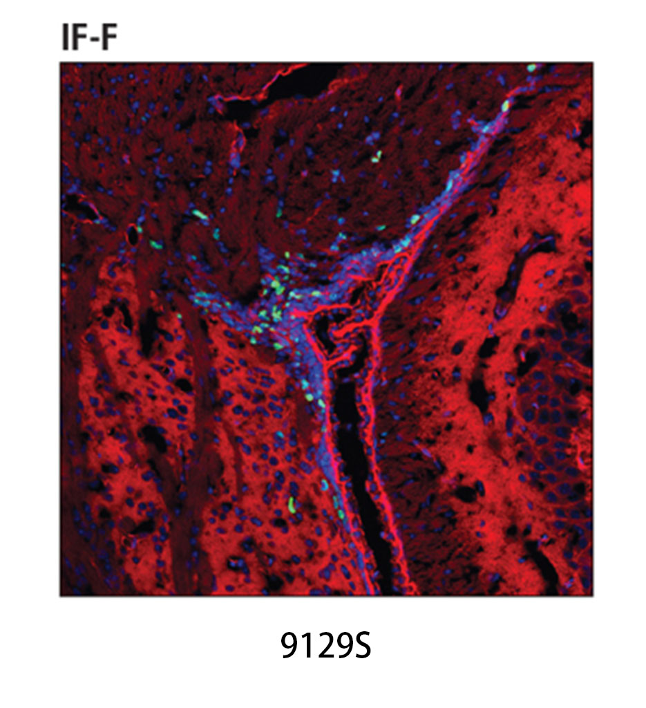 Ki-67 (D3B5) Rabbit mAb
