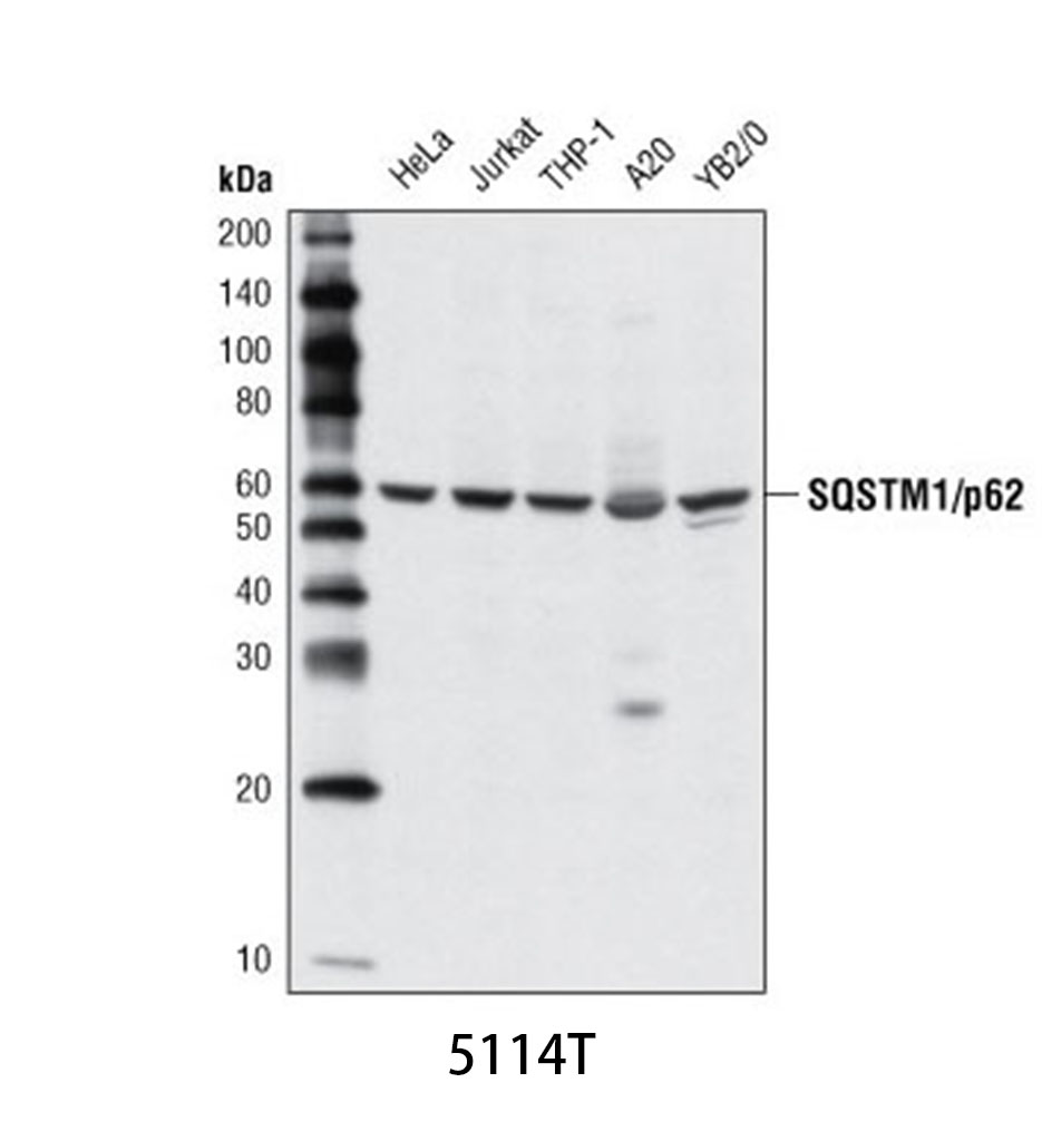 SQSTM1/p62 Antibody