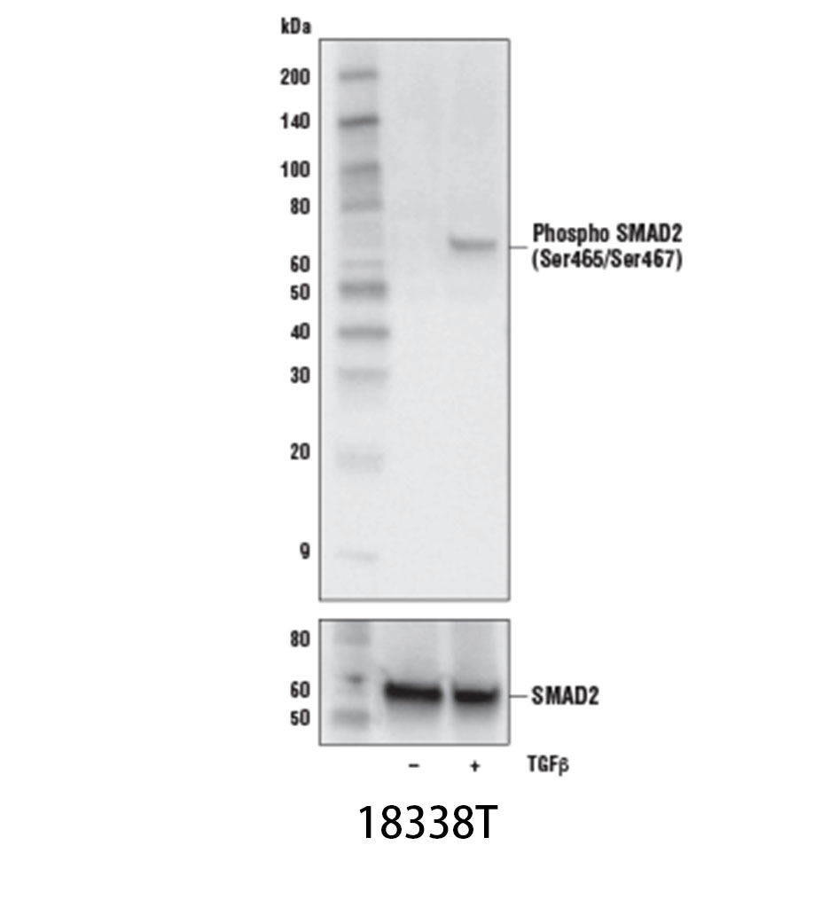 Phospho-SMAD2 (Ser465/Ser467) (E8F3R) Rabbit mAb