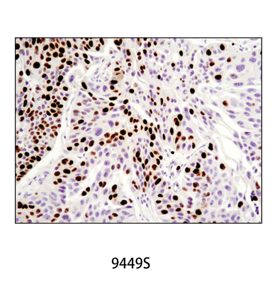 Ki-67 (8D5) Mouse mAb