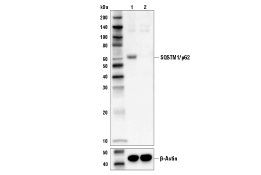 SQSTM1/p62 (D5E2) Rabbit mAb