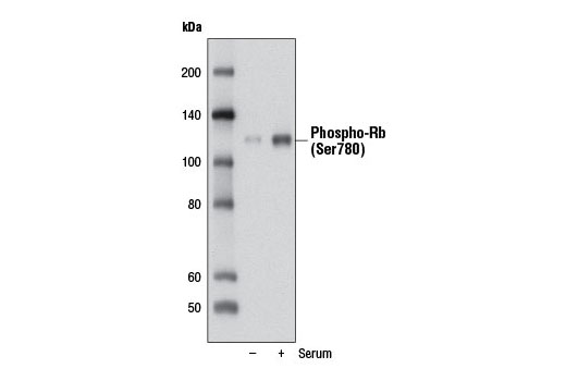 Phospho-Rb (Ser780) (D59B7) Rabbit mAb