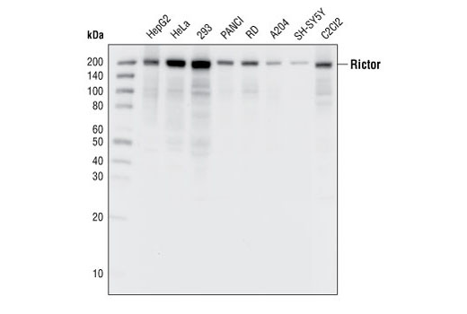 mTOR Pathway Antibody Sampler Kit