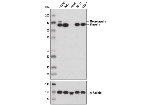 Vinculin (E1E9V) XP Rabbit mAb