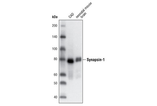 Synapsin-1 (D12G5) XP Rabbit mAb