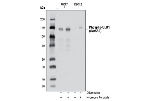 Phospho-ULK1 (Ser555) (D1H4) Rabbit mAb