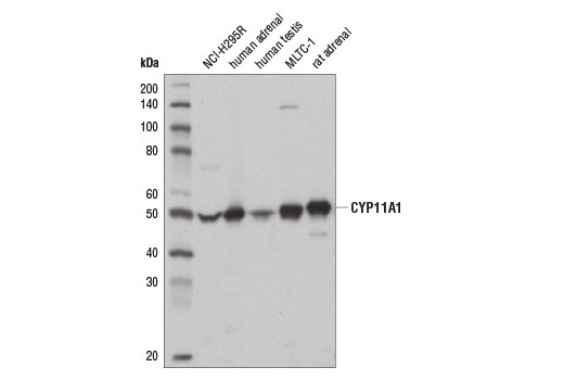 CYP11A1 (D8F4F) Rabbit mAb