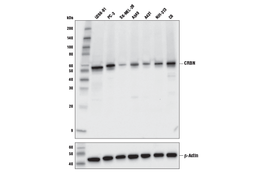 CRBN (D8H3S) Rabbit mAb