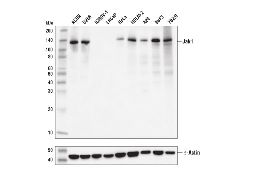 Jak1 (D1T6W) Mouse mAb