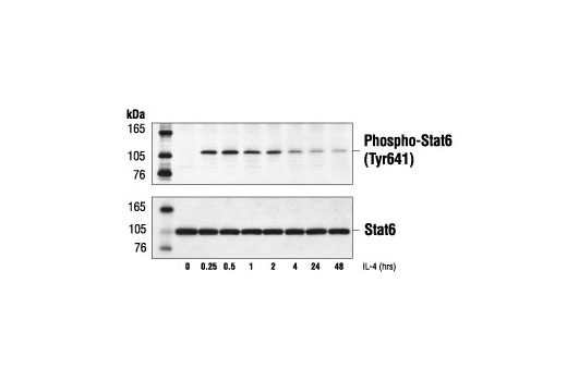 Phospho-Stat6 (Tyr641) Antibody