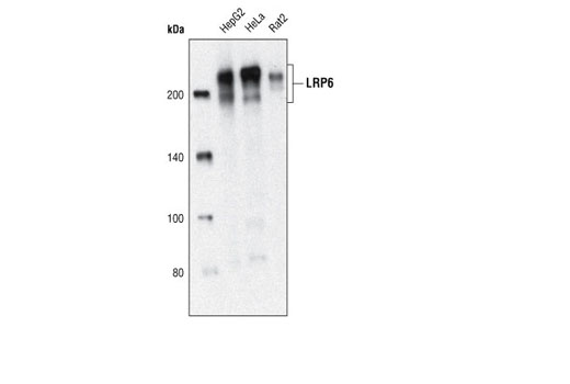 LRP6 (C5C7) Rabbit mAb