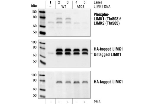Phospho-LIMK1 (Thr508)/LIMK2 (Thr505) Antibody
