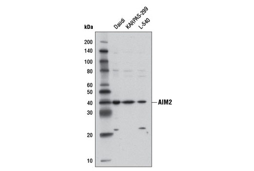 AIM2 (D5X7K) Rabbit mAb