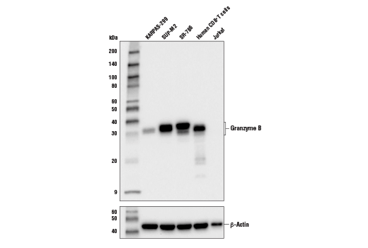 Granzyme B (D2H2F) Rabbit mAb