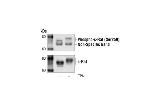 Phospho-c-Raf (Ser259) Antibody