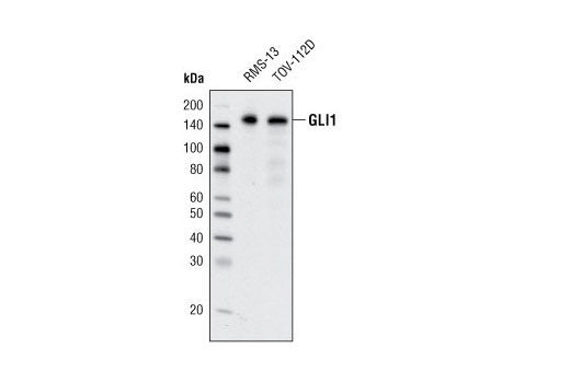 GLI1 (C68H3) Rabbit mAb