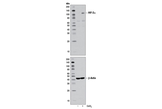 HIF-2α (D9E3) Rabbit mAb