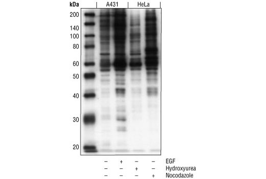 Phospho-MAPK/CDK Substrates (PXS*P or S*PXR/K) (34B2) Rabbit mAb
