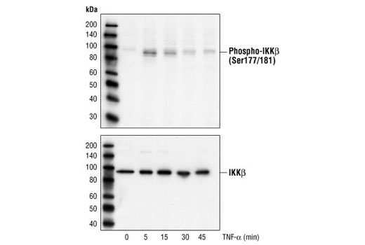 Phospho-IKKα/β (Ser176/180) Antibody II