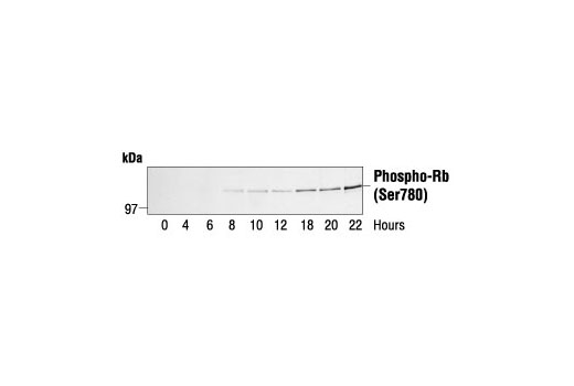 Phospho-Rb (Ser780) Antibody