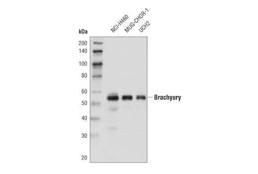 Brachyury (D2Z3J) Rabbit mAb