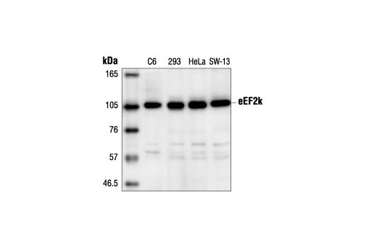 eEF2k Antibody