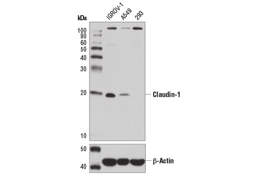 Claudin-1 (D3H7C) Rabbit mAb