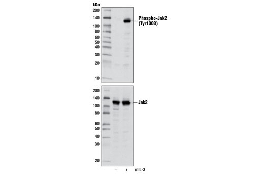 Phospho-Jak2 (Tyr1008) (D4A8) Rabbit mAb
