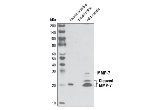 MMP-7 (D4H5) XP Rabbit mAb
