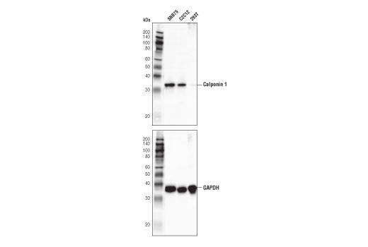 Calponin 1 (D8L2T) XP Rabbit mAb