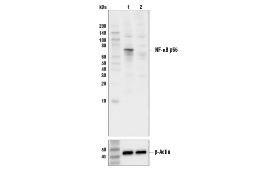 NF-κB p65 (C22B4) Rabbit mAb