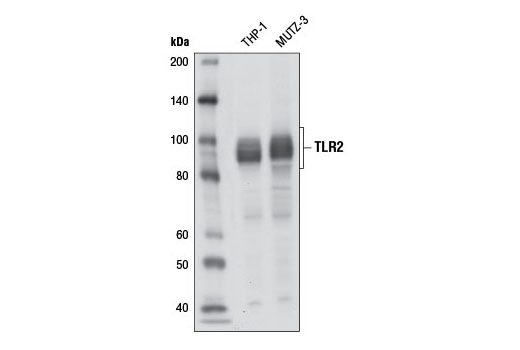 Toll-like Receptor 2 (D7G9Z) Rabbit mAb