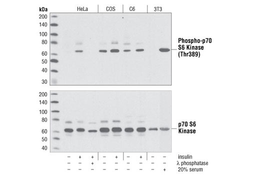 Phospho-p70 S6 Kinase (Thr389) Antibody