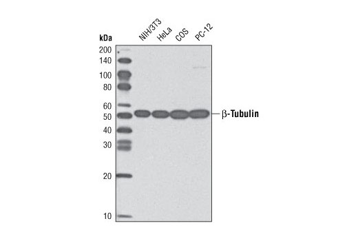 β-Tubulin (9F3) Rabbit mAb (HRP Conjugate)