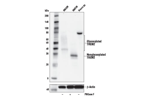 TREM2 (E6T1P) Rabbit mAb (Amino-terminal Antigen Mouse Specific)