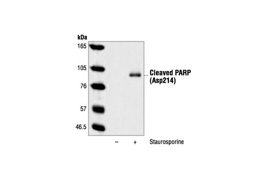 Cleaved PARP (Asp214) (7C9) Mouse mAb (Mouse Specific)