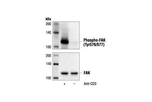 Phospho-FAK (Tyr576/577) Antibody