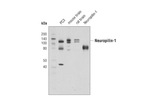 Neuropilin-1 (D62C6) Rabbit mAb