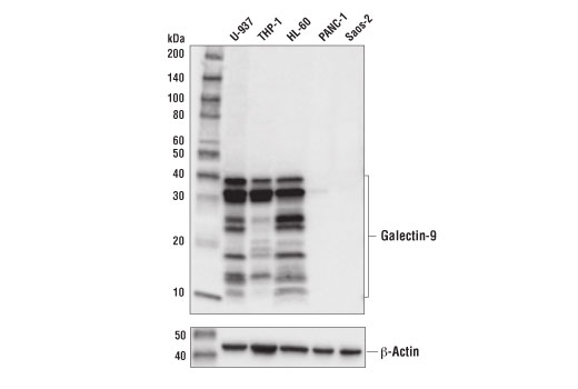 Galectin-9 (D9R4A) XP Rabbit mAb