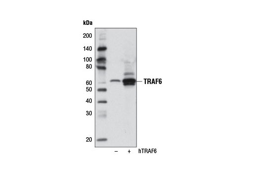 TRAF6 (D21G3) Rabbit mAb