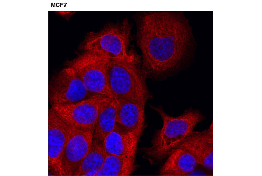 Pan-Keratin (C11) Mouse mAb (Alexa Fluor 555 Conjugate)
