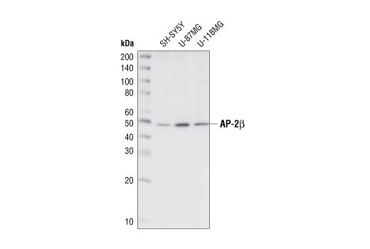 AP-2β Antibody