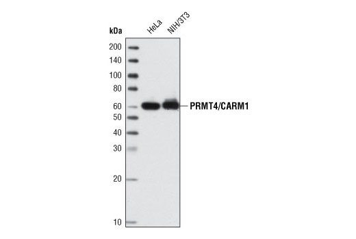 PRMT4/CARM1 (C31G9) Rabbit mAb