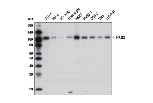PKD2 (D1A7) Rabbit mAb