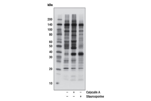 Phospho-CK2 Substrate [(pS/pT)DXE] MultiMab Rabbit mAb mix